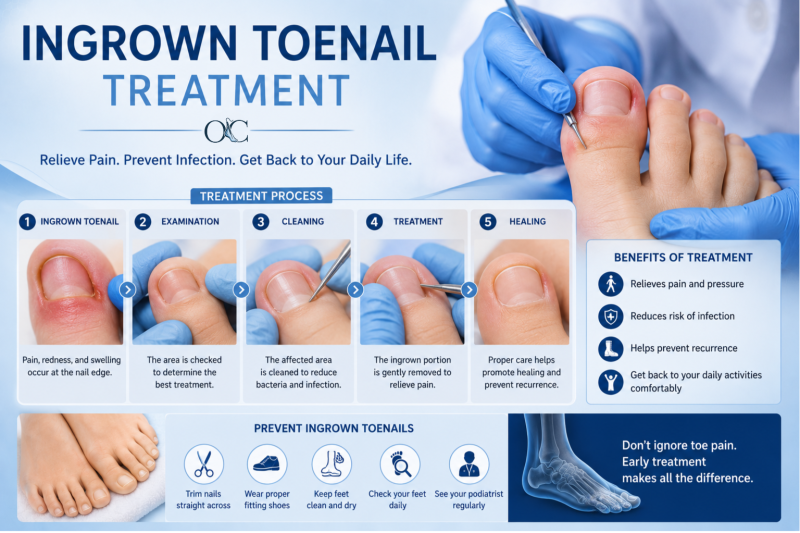 ingrown toenail treatment